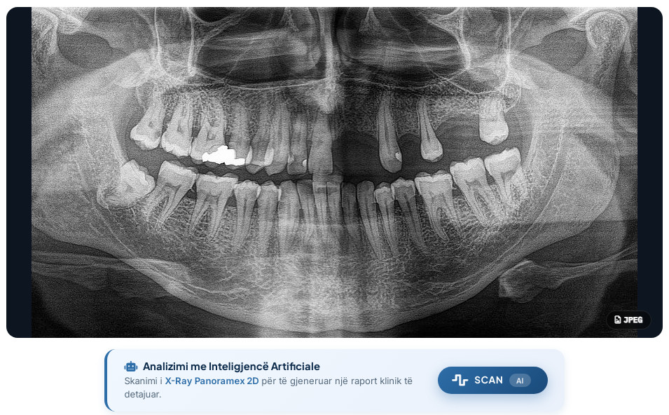 Panoramex X-Ray with Artificial Intelligence
